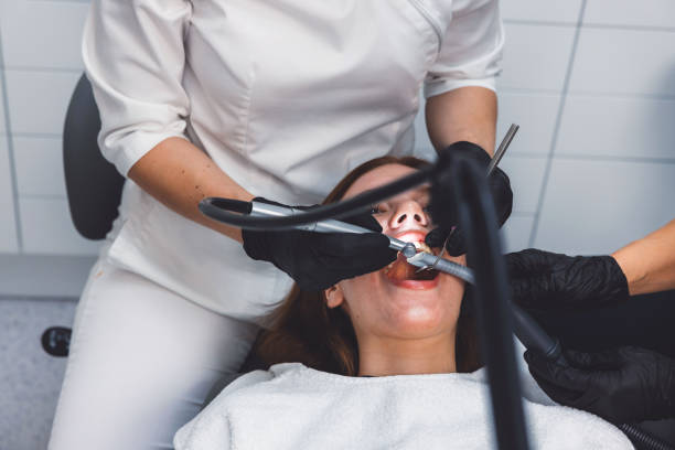 Best Emergency Wisdom Teeth Removal in Mason City, IA