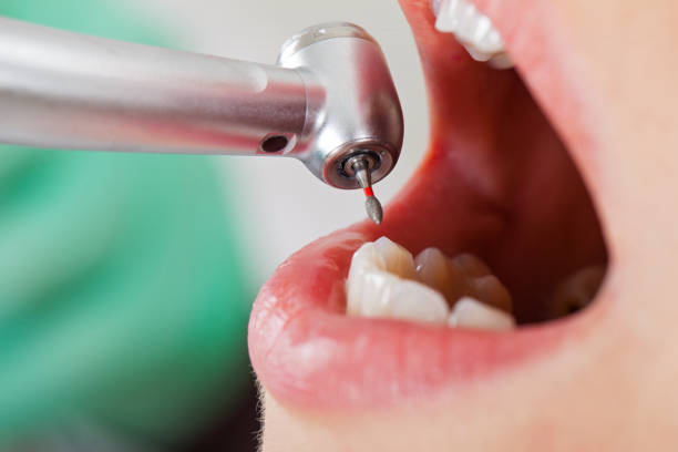 Best Pediatric Emergency Dentist in Mason City, IA